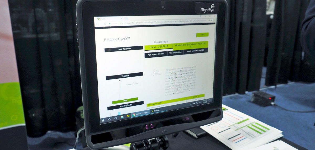 Tobii partner - RightEye
