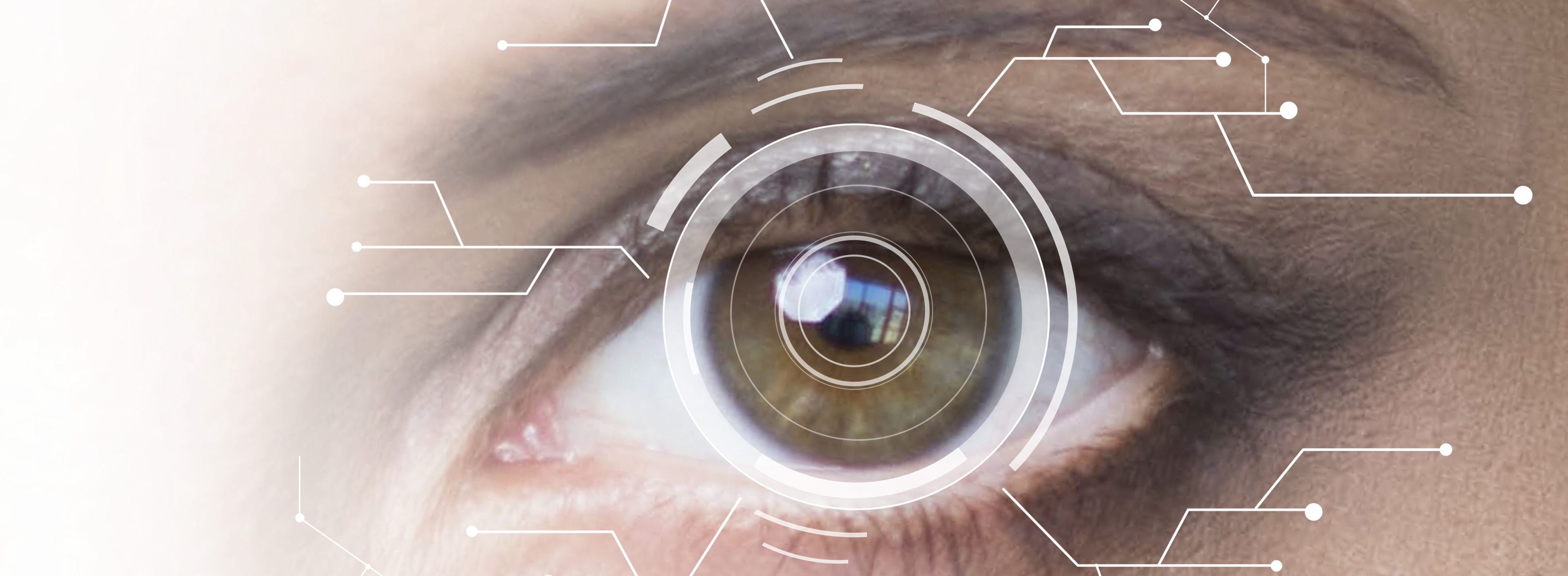 Using eye tracking to diagnose eye movement disorders Tobii